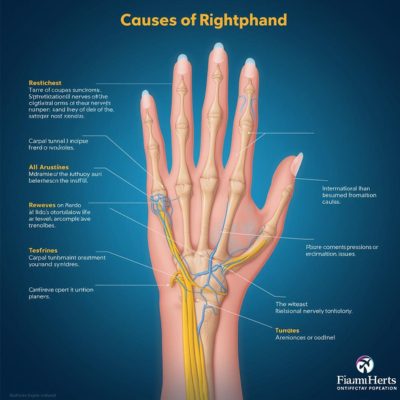 Right Hand Numbness Spiritual Meaning